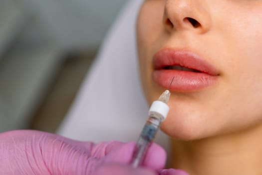 Injection procedure for lip augmentation, close-up. The cosmetologist slowly and carefully injects filler into the client lips. Advertising concept for facial care, youth and beauty.