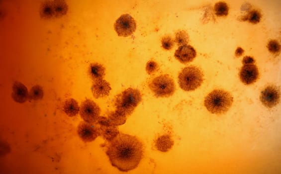 Close-up of microbes under microscope investigated material under professional laboratory equipment. Macro shot of aspergillus germ. Lab, science concept