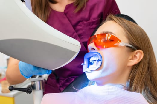 Close up procedure of whitening of teeth using UV lamp for blond woman at dentist clinic