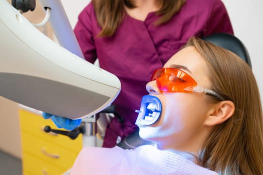 Teeth whitening for woman and application of UV lamp for bleaching teeth at dentist clinic