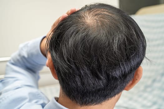 Bald in the middle head and begin no loss hair glabrous of mature Asian business smart active office man.