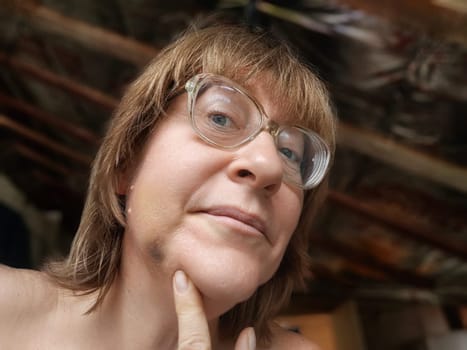 A woman with a swollen cheek and visible bruise reveals evidence of domestic violence and poor dental health in a home setting.