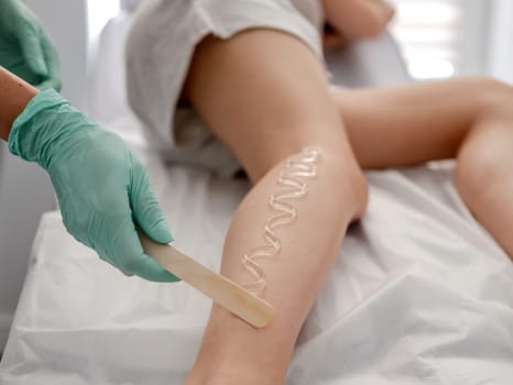 Master Of Laser Hair Removal Applies Gel To Girl'S Leg In Close-Up