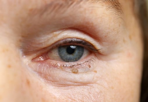 Close-up of elderly womans eye. Macro shot of senior female looking in camera. Beautiful blue colour eyeball. Wrinkles and moles. Youth and ageing. Natural beauty concept