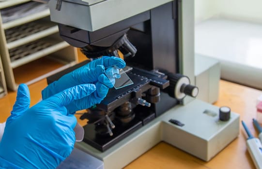 Examine in the laboratory under a microscope. Selective focus. medicine.