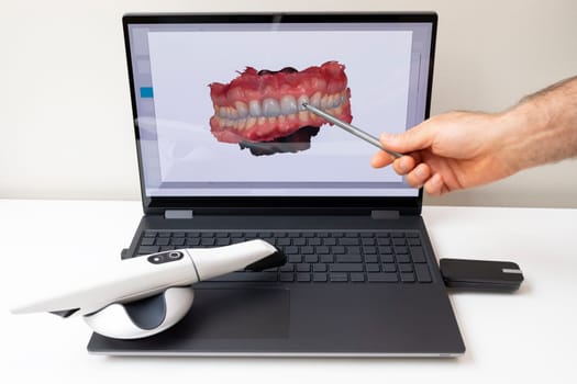 Dentist Shows 3D Scanned Picture of Scanned Teeth on Monitor of Computer, White 3d Intraoral Dental Tooth Scanner Lying on Table. Dental Equipment, Device For Scanning Teeth. Dentistry. Horizontal