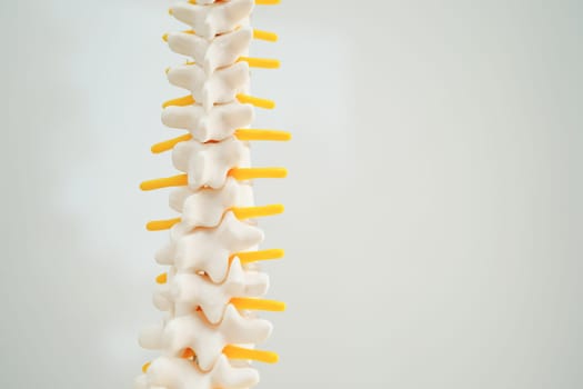 Spinal nerve and bone, Lumbar spine displaced herniated disc fragment, Model for treatment medical in the orthopedic department.
