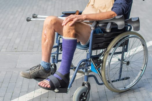 middle-aged Caucasian man sits in a wheelchair with a cast on his broken leg, holding crutches in his hands,concept of two possible modes of movement for person,