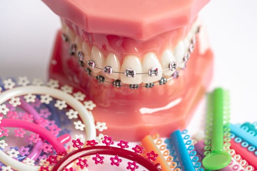 Orthodontic ligatures rings and ties, elastic rubber bands on orthodontic braces, model for dentist studying about dentistry.