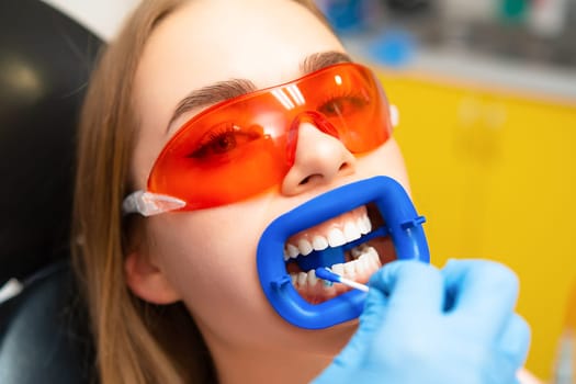 Dentist applies dental plaque gel detector to young woman patient in orange protective goggles teeth in dental clinic.