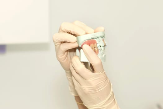 Dentist shows plaster cast of teeth wearing gloves