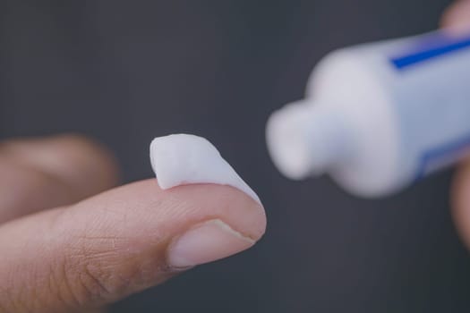 A finger dipped in cream from a tube, perfectly poised and ready for application on skin