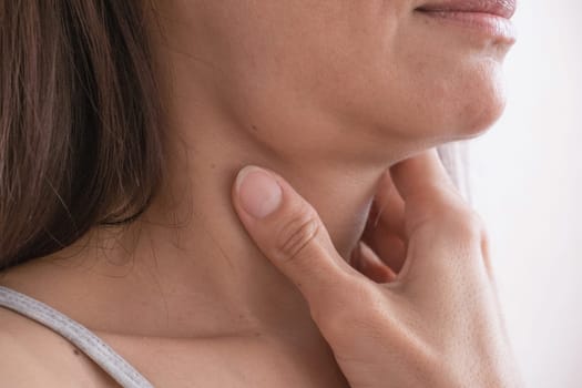 Cervical lymphadenitis of the right side in a woman