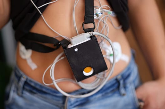 Ecg holter monitor hanging on patient body closeup. Diagnosis of rhythm and conduction disorders concept