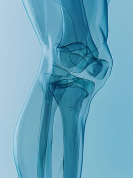 An aquacolored xray image displays the human legs bones within the knee area. The transparent material reveals the intricate human anatomy of the bone structure