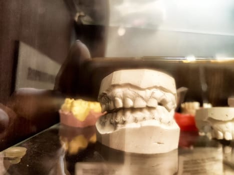 Detailed dental casts arranged in a hospital dental office, highlighting patient models and various dental impressions for examination.