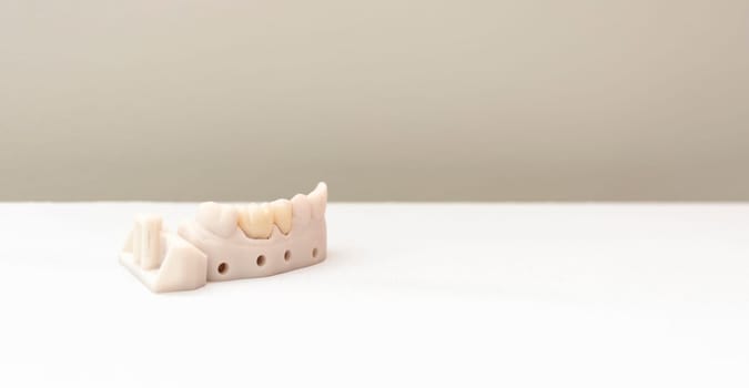 Banner Tooth Crown or Dental Cap in Box, Implant Model Tooth Support On White Table. Copy Space for Text. Crown Delivery. Bridge Placement. Horizontal Plane. High quality photo