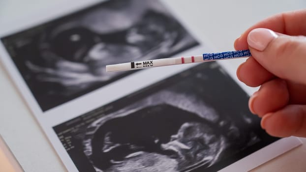 Woman holding a positive pregnancy test on the background of a photo with an ultrasound
