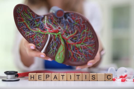 A comprehensive and detailed liver model that illustrates hepatitis C, crucial for enhancing healthcare education