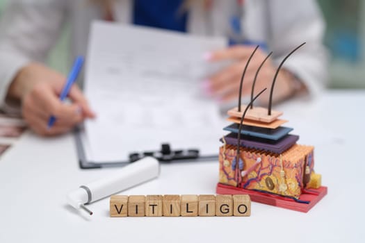 A detailed skin model showcasing the distinct effects of vitiligo and emphasizing its unique clinical features