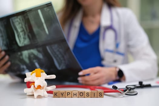 A healthcare professional reviews Xrays of kyphosis while a spine model is placed on the table for analysis