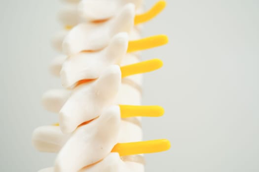 Spinal nerve and bone, Lumbar spine displaced herniated disc fragment, Model for treatment medical in the orthopedic department.