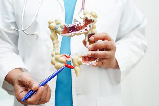 Intestine, doctor holding anatomy model for study diagnosis and treatment in hospital.