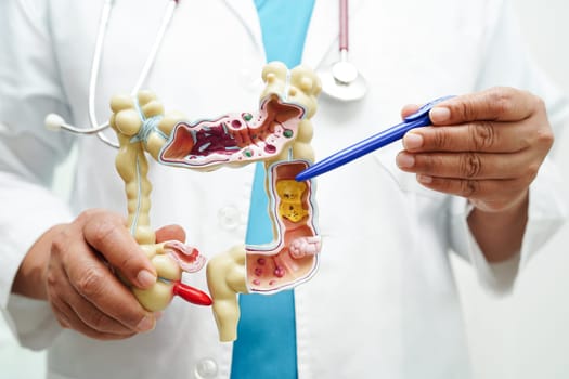 Intestine, doctor holding anatomy model for study diagnosis and treatment in hospital.