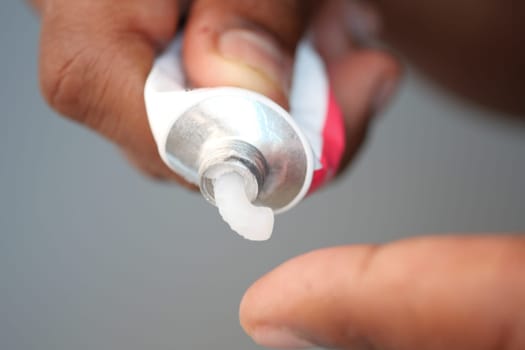 Hand applying cream from a tube onto a fingertip.