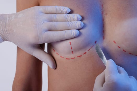 Woman and doctor with lancet on white background, closeup. Concept of breast augmentation.