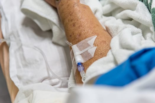 Patient in the hospital with saline intravenous on a elderly patient hand