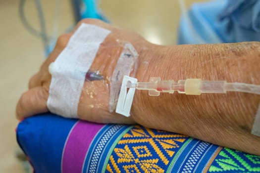 A patient in the hospital with saline intravenous, in Asian elderly man hand