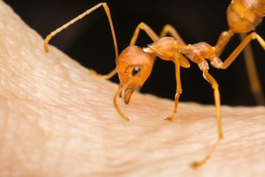 Macro of ant (Red Ant or Green Tree Ant) biting on the human skin for self-defense or self-protection from human