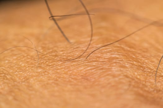 Macro of dry skin asian human with black hairy and pores on wrinkles skin