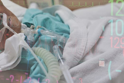 Patient asian elder women 80s do tracheostomy use ventilator for breathing help on bed in the hospital overlap with monitor display graph for pulse of heart rate and blood pressure.