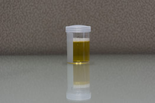 Urine sample testing in plastic bottle for examination in laboratory hospital