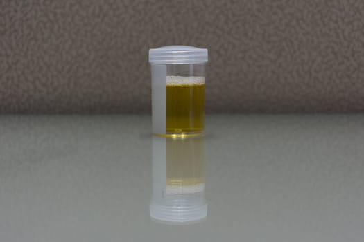 Urine sample testing in plastic bottle for examination in laboratory hospital