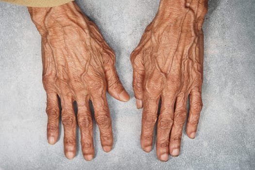 Hands of an elderly individual showing age and experience while resting.