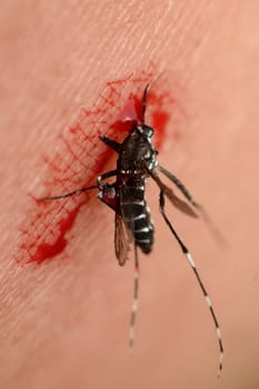 Macro of mosquito sucking blood close up on the human skin. Mosquito is carrier of Malaria, Encephalitis, Dengue and Zika virus