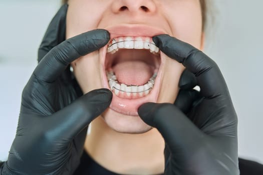 Close-up of open mouth with teeth with metal orthodontic plate, hands of orthodontist doctor in black medical gloves showing her teeth. Treatment, dental care, orthodontics, dentistry, health concept