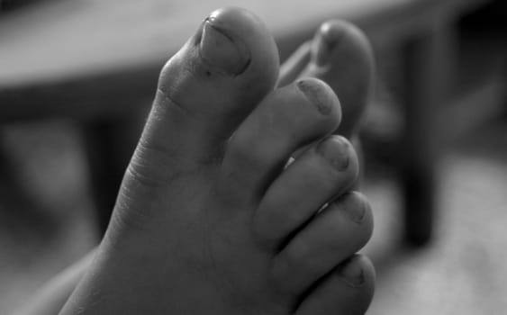 Well,to whom does such a foot belong?