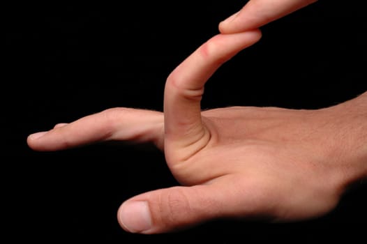 EDS (Ehlers-Danlos syndrome) is a rare hereditary disease that affects the skin and joints. Hyperextensible skin/joints.
