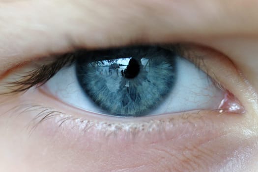 Eye