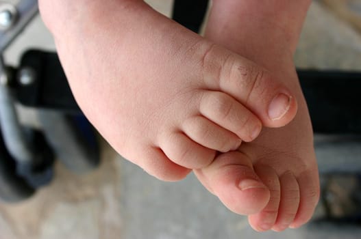 Small feet