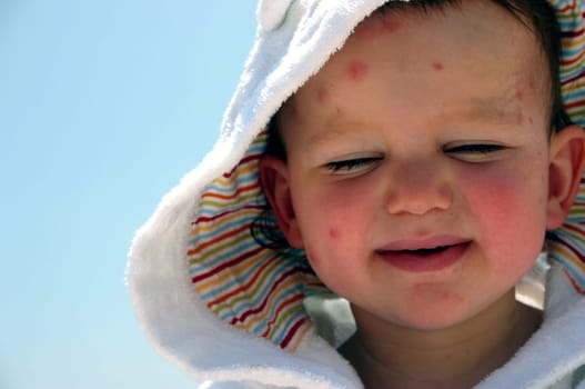 The poor little one had over 50 mosquito bites after the first night in Mykonos...