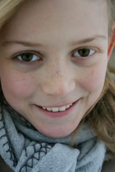 ... And Sandra has something very special: One eye with brown eyelashes and the other with blonde ones and I was the first to notice it 12 years ago. Well,if that's not something special?