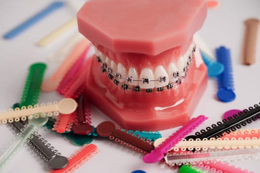 Orthodontic ligatures rings and ties, elastic rubber bands on orthodontic braces, model for dentist studying about dentistry.