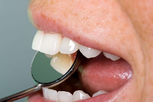 Dental inspection with mirror