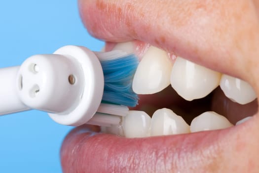 Teeth cleaning