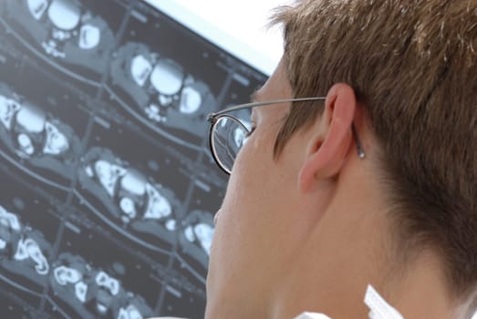 Doctor looks at an X-ray